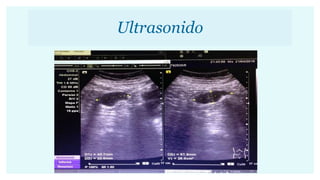 Ultrasonido
 
