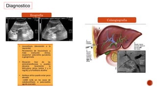 Diagnostico
Colangiografia
Ecografía
 
