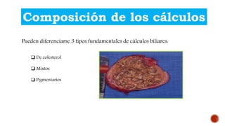 Composición de los cálculos
Pueden diferenciarse 3 tipos fundamentales de cálculos biliares:
 De colesterol
 Mixtos
 Pigmentarios
 