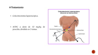 Tratamiento
• Colecistectomía laparoscópica.
• AUDC a dosis de 10 mg/kg de
peso/día, dividido en 3 tomas.
 