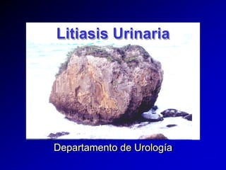 Litiasis Urinaria




Departamento de Urología
Departamento de Urología
 