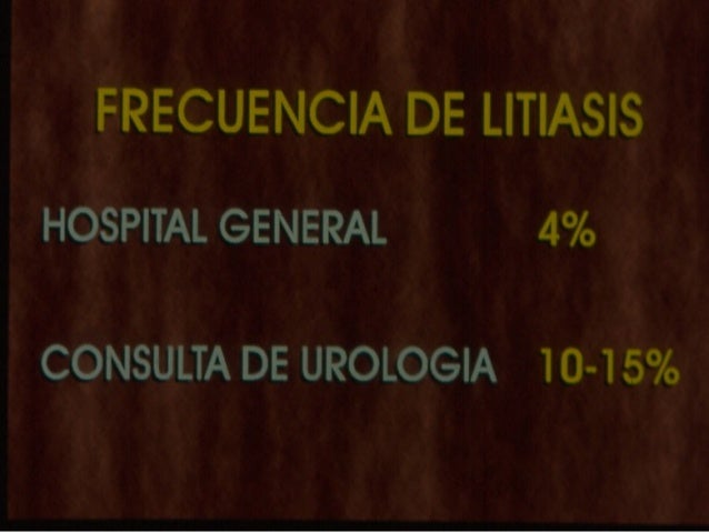 Litiasis 4