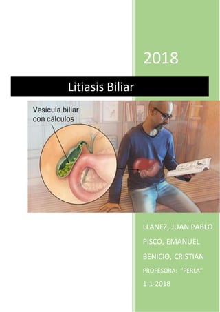 2018
LLANEZ, JUAN PABLO
PISCO, EMANUEL
BENICIO, CRISTIAN
PROFESORA: “PERLA”
1-1-2018
Litiasis Biliar
 
