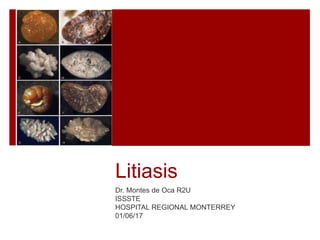 Litiasis
Dr. Montes de Oca R2U
ISSSTE
HOSPITAL REGIONAL MONTERREY
01/06/17
 