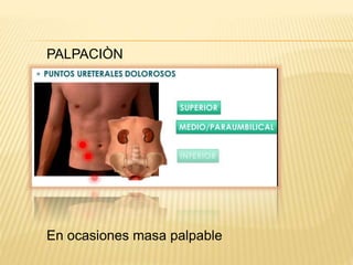 PALPACIÒN
En ocasiones masa palpable
 