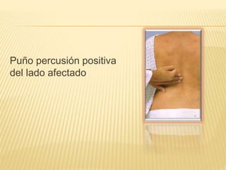 Puño percusión positiva
del lado afectado
 