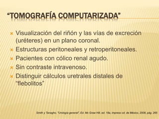 “TOMOGRAFÍA COMPUTARIZADA”
 Visualización del riñón y las vías de excreción
(uréteres) en un plano coronal.
 Estructuras peritoneales y retroperitoneales.
 Pacientes con cólico renal agudo.
 Sin contraste intravenoso.
 Distinguir cálculos uretrales distales de
“flebolitos”
Smith y Tanagho, "Urología general", Ed. Mc Graw Hill, ed. 18a, impreso cd. de México, 2008, pág. 265
 