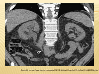 Disponible en: http://www.elsevier.es/imatges/119/119v53nSupl.1/grande/119v53nSupl.1-90028132fig3.jpg
 