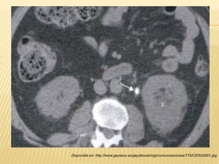 Disponible en: http://www.geyseco.es/geystiona/imgs/comunicaciones/175/C00520001.jpg
 