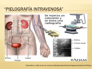 “PIELOGRAFÍA INTRAVENOSA”
Disponible en: https://www.nlm.nih.gov/medlineplus/spanish/ency/images/ency/fullsize/19245.jpg
 