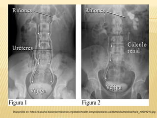 Disponible en: https://espanol.kaiserpermanente.org/static/health-encyclopedia/es-us/kb/media/medical/hw/s_h9991213.jpg
 