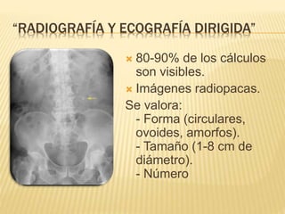 “RADIOGRAFÍA Y ECOGRAFÍA DIRIGIDA”
 80-90% de los cálculos
son visibles.
 Imágenes radiopacas.
Se valora:
- Forma (circulares,
ovoides, amorfos).
- Tamaño (1-8 cm de
diámetro).
- Número
 