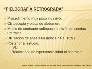 “PIELOGRAFÍA RETROGRADA”
 Procedimiento muy poco invasivo.
 Cistoscopia y placa de abdomen.
 Medio de contraste radiopaco a través de sondas
uretrales.
 Utilización de anestesia (lidocaína al 10%).
 Posterior al estudio:
- IVU
- Reacciones de hipersensibilidad al contraste.
Smith y Tanagho, "Urología general", Ed. Mc Graw Hill, ed. 18a, impreso cd. de México, 2008, pág. 66
 