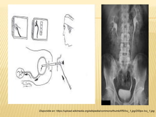 Disponible en: https://upload.wikimedia.org/wikipedia/commons/thumb/f/f5/Ivu_1.jpg/200px-Ivu_1.jpg
 