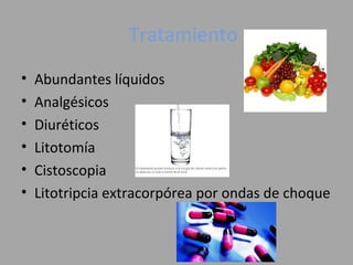 Tratamiento
• Abundantes líquidos
• Analgésicos
• Diuréticos
• Litotomía
• Cistoscopia
• Litotripcia extracorpórea por ondas de choque
 