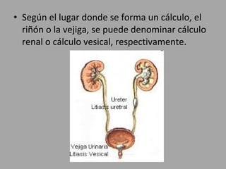 • Según el lugar donde se forma un cálculo, el
riñón o la vejiga, se puede denominar cálculo
renal o cálculo vesical, respectivamente.
 