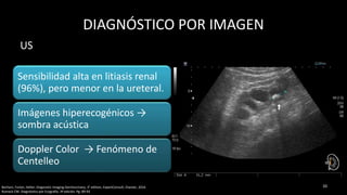 DIAGNÓSTICO POR IMAGEN
Sensibilidad alta en litiasis renal
(96%), pero menor en la ureteral.
Imágenes hiperecogénicos →
sombra acústica
Doppler Color → Fenómeno de
Centelleo
1010Borhani, Furlan, Heller; Diagnostic Imaging Genitourinary, 3° edition, ExpertConsult, Elsevier, 2016
Rumack CM. Diagnóstico por Ecografía. 3ª edición. Pg. 89-93
US
 