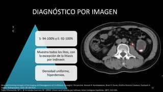DIAGNÓSTICO POR IMAGEN
S: 94-100% y E: 92-100%
Muestra todos los litos, con
la excepción de la litiasis
por indinavir.
Densidad uniforme,
hiperdensos.
12
New and Evolving Concepts in the Imaging and Management of Urolithiasis: Urologists’ Perspective. Avinash R. Kambadakone, Brian H. Eisner, Onofrio Antonio Catalano, Dushyant V.
Sahani. Radiographics. 2010. 30: 603-623.
Traba Villameytide, Mª L., & Fernández-Guerrero, M.. (2004). Litiasis renal inducida por Indinavir. Actas Urológicas Españolas, 28(7), 523-526.
T
C
 