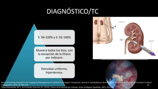 DIAGNÓSTICO/TC
S: 94-100% y E: 92-100%
Muestra todos los litos, con
la excepción de la litiasis
por indinavir.
Densidad uniforme,
hiperdensos.
14
New and Evolving Concepts in the Imaging and Management of Urolithiasis: Urologists’ Perspective. Avinash R. Kambadakone, Brian H. Eisner, Onofrio Antonio Catalano, Dushyant V. Sahani.
Radiographics. 2010. 30: 603-623.
Traba Villameytide, Mª L., & Fernández-Guerrero, M.. (2014). Litiasis renal inducida por Indinavir. Actas Urológicas Españolas, 28(7), 523-526.
 