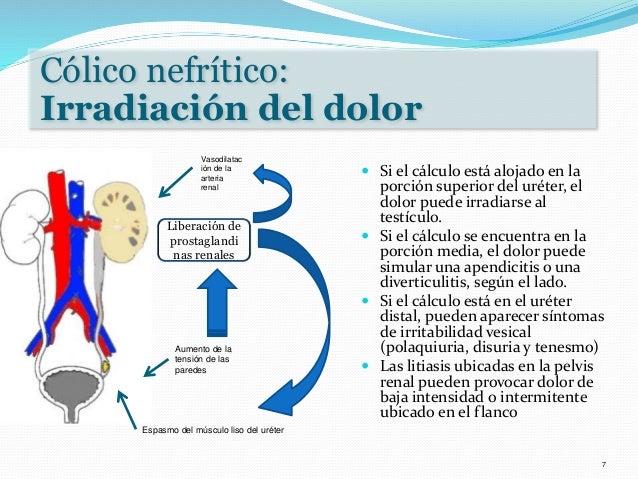 El dolor que duele en el lado derecho por parte de la espalda abajo