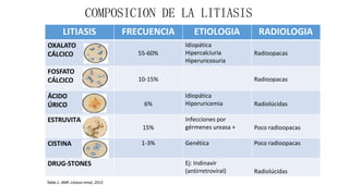 COMPOSICION DE LA LITIASIS
LITIASIS FRECUENCIA ETIOLOGIA RADIOLOGIA
OXALATO
CÁLCICO 55-60%
Idiopática
Hipercalciuria
Hiperuricosuria
Radioopacas
FOSFATO
CÁLCICO 10-15% Radioopacas
ÁCIDO
ÚRICO 6%
Idiopática
Hiperuricemia Radiolúcidas
ESTRUVITA
15%
Infecciones por
gérmenes ureasa + Poco radioopacas
CISTINA 1-3% Genética Poco radioopacas
DRUG-STONES Ej: Indinavir
(antirretroviral) Radiolúcidas
Tabla 1. AMF. Litiasis renal, 2015
 