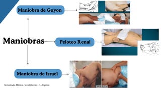 Maniobra de Guyon
Peloteo Renal
Maniobra de Israel
Maniobras
Semiología Médica, 3era Edición - H. Argente
 