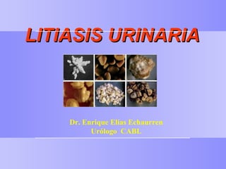 LITIASIS URINARIA   Dr. Enrique Elías Echaurren Urólogo  CABL 