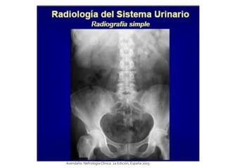 Avendaño. NefrologíaClínica. 2a Edición, España 2003
 