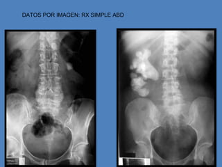 DATOS POR IMAGEN: RX SIMPLE ABD
 