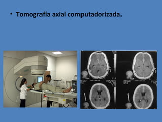 • Tomografía axial computadorizada.
 