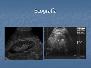 Ecografía
 