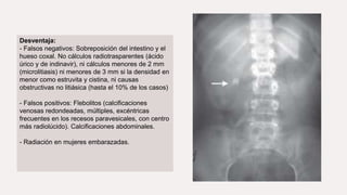 Desventaja:
- Falsos negativos: Sobreposición del intestino y el
hueso coxal. No cálculos radiotrasparentes (ácido
úrico y de indinavir), ni cálculos menores de 2 mm
(microlitiasis) ni menores de 3 mm si la densidad en
menor como estruvita y cistina, ni causas
obstructivas no litiásica (hasta el 10% de los casos)
- Falsos positivos: Flebolitos (calcificaciones
venosas redondeadas, múltiples, excéntricas
frecuentes en los recesos paravesicales, con centro
más radiolúcido). Calcificaciones abdominales.
- Radiación en mujeres embarazadas.
 