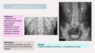 Urografía intravenosa (UIV)
Hallazgos:
- Retraso en la
aparición del contraste
en el sistema
pielocalicial.
- Dilatación ureteral
proximal a la zona
obstruida, pudiendo
identificar la causa
Ventaja:
- Fiable, accesible, económico y relativamente inocuo.
Desventaja:
- El medio de contraste, que tiene
contraindicaciones y las reacciones
alergias
 