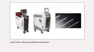 Laser Holmio y fibras para litotripsia intracorporea.
 