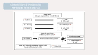 Nefrolitectomía endoscópica
retrógrada flexible (RIRS)
 
