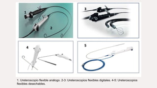 1. Ureteroscopio flexible análogo. 2-3: Ureteroscopios flexibles digitales. 4-5: Ureteroscopios
flexibles desechables.
 