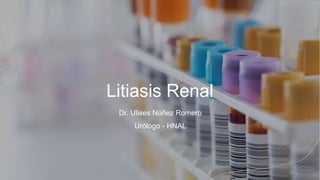 Litiasis Renal
Dr. Ulises Núñez Romero
Urólogo - HNAL
 