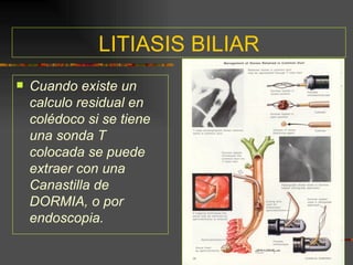 LITIASIS BILIAR
   Cuando existe un
    calculo residual en
    colédoco si se tiene
    una sonda T
    colocada se puede
    extraer con una
    Canastilla de
    DORMIA, o por
    endoscopia.
 