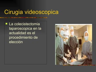 Cirugia videoscopica
   La colecistectomia
    laparoscopica en la
    actualidad es el
    procedimiento de
    elección
 