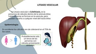 Lithiasis: Anatomy, Physiology, Diagnosis, and Treatment | PPTX
