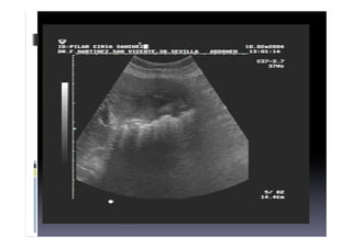 diagnostico
 Foto ecografia
 