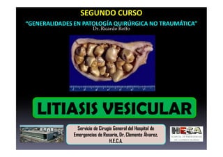 SEGUNDO CURSO
“GENERALIDADES EN PATOLOGÍA QUIRÚRGICA NO TRAUMÁTICA”
Dr. Ricardo Roffo
Servicio de Cirugía General del Hosp...