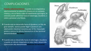 COMPLICACIONES
• Fistulas colecistoentéricas: Cuando no se diagnóstica
oportunamente la colecistitis litiasica en un contexto
crónico, y no se lleva a cabo el tratamiento quirúrgico, la
vesícula puede adherirse hacia el estomago, duodeno, o
colon y provocar una fistula.
 Cuando esta se desarrolla hacia el duodeno y el lito de
gran tamaño avanza puede llegar a producir una
obstrucción intestinal mecánica por el lito impactado
previo o cerca a la válvula ileocecal en el íleo terminal
denominándose Ileo Biliar
 Cuando esta se desarrolla hacia el estomago o duodeno
y queda un cálculo impactado en este nivel y desarrolla
obstrucción alta denominado Síndrome de Bouveret
 