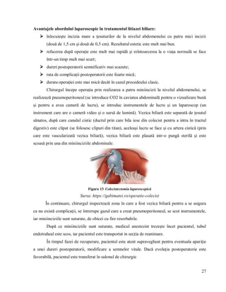 27
Avantajele abordului laparoscopic în tratamentul litiazei biliare:
 înlocuiește incizia mare a țesuturilor de la nivelul abdomenului cu patru mici incizii
(două de 1,5 cm și două de 0,5 cm). Rezultatul estetic este mult mai bun.
 refacerea după operație este mult mai rapidă și reîntoarcerea la o viața normală se face
într-un timp mult mai scurt;
 dureri postoperatorii semnificativ mai scazute;
 rata de complicații postoperatorii este foarte mică;
 durata operației este mai mică decât în cazul procedeului clasic.
Chirurgul începe operația prin realizarea a patru miniincizii la nivelul abdomenului, se
realizează pneumoperitoneul (se introduce CO2 în caviatea abdominală pentru o vizualizare bună
și pentru a avea cameră de lucru), se introduc instrumentele de lucru și un laparoscop (un
instrument care are o cameră video și o sursă de lumină). Vezica biliară este separată de țesutul
sănatos, după care canalul cistic (ductul prin care bila iese din colecist pentru a intra în tractul
digestiv) este clipat (se folosesc clipuri din titan), aceleași lucru se face și cu artera cistică (prin
care este vascularizată vezica biliară), vezica biliară este plasată intr-o pungă sterilă și este
scoasă prin una din miniinciziile abdominale.
Figura 13 Colecistectomia laparoscopică
Sursa: https://gabimatei.ro/operatie-colecist
În continuare, chirurgul inspectează zona în care a fost vezica biliară pentru a se asigura
ca nu există complicații, se întrerupe gazul care a creat pneumoperitoneul, se scot instrumentele,
iar miniinciziile sunt suturate, de obicei cu fire resorbabile.
După ce miniinciziile sunt suturate, medicul anestezist trezește încet pacientul, tubul
endotraheal este scos, iar pacientul este transportat in secția de reanimare.
În timpul fazei de recuperare, pacientul este atent supravegheat pentru eventuala apariție
a unei dureri postoperatorii, modificare a semnelor vitale. Dacă evoluția postoperatorie este
favorabilă, pacientul este transferat în salonul de chirurgie.
 