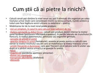 Litiaza urinară | PPTX