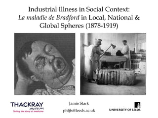 Industrial Illness in Social Context: La maladie de Bradford  in Local, National & Global Spheres (1878-1919) Jamie Stark [email_address] 