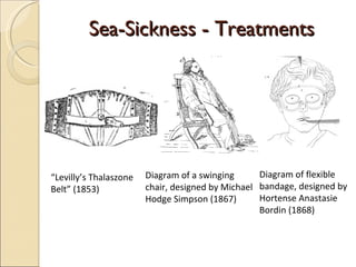 Sea-Sickness - Treatments “ Levilly’s Thalaszone Belt” (1853)   Diagram of a swinging chair, designed by Michael Hodge Simpson (1867)   Diagram of flexible bandage, designed by Hortense Anastasie Bordin (1868) 