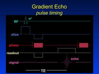 Mri Gradient Timing 141 physics of mri | PPT