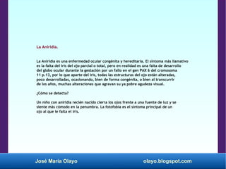 José María Olayo olayo.blogspot.com
La Aniridia.
La Aniridia es una enfermedad ocular congénita y hereditaria. El síntoma más llamativo
es la falta del iris del ojo parcial o total, pero en realidad es una falta de desarrollo
del globo ocular durante la gestación por un fallo en el gen PAX 6 del cromosoma
11 p.13, por lo que aparte del iris, todas las estructuras del ojo están alteradas,
poco desarrolladas, ocasionando, bien de forma congénita, o bien al transcurrir
de los años, muchas alteraciones que agravan su ya pobre agudeza visual.
¿Cómo se detecta?
Un niño con aniridia recién nacido cierra los ojos frente a una fuente de luz y se
siente más cómodo en la penumbra. La fotofobia es el síntoma principal de un
ojo al que le falta el iris.
 