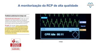A monitorização da RCP de alta qualidade
Vídeo
 